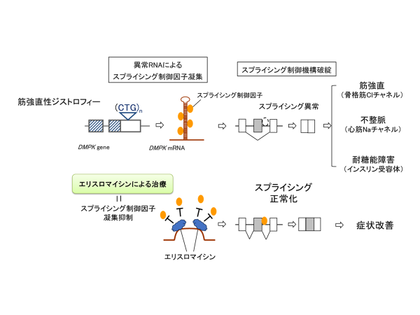 筋強直性ジストロフィーに対する世界初の根本的治療薬開発 ～医師主導第二相治験により有効性を支持する成果～