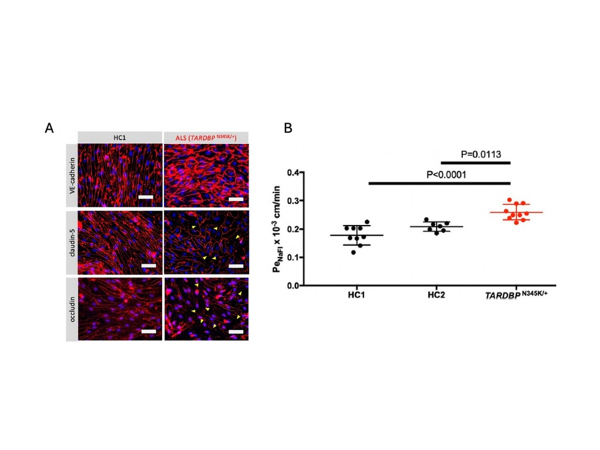 ALS患者における血液脳関門破綻の解明につながる新たなモデルを開発!~これまでとは全く異なる標的に対する新しい治療法開発への期待~
