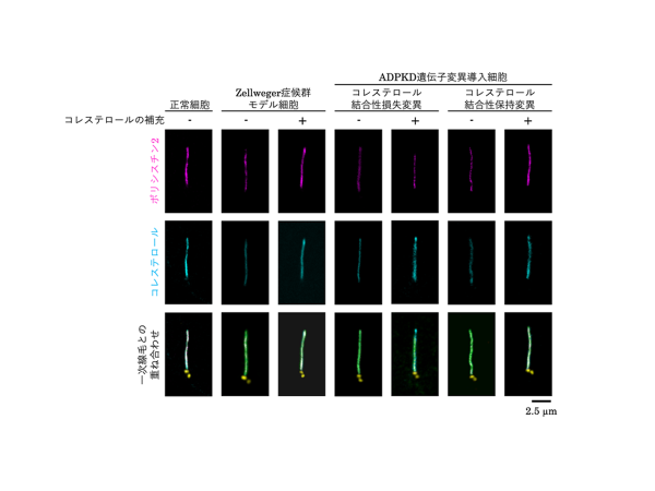 遺伝性難病・多発性嚢胞腎の発症を防ぐコレステロールの新機能を発見~コレステロールは細胞の「センサー(一次線毛)」の感度を高く保つ~