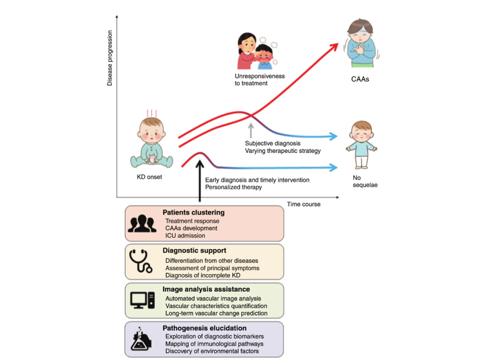The future of Kawasaki disease management: data-driven innovations from bedside to bench and back again