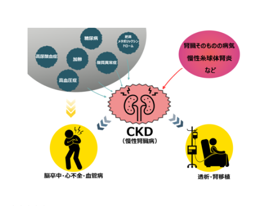 ＊お知らせ＊　山口県で慢性腎臓病（CKD）対策として新認定制度を開始～かかりつけ医と専門医の連携強化で重症化予防を目指す「心腎代謝診療医」～