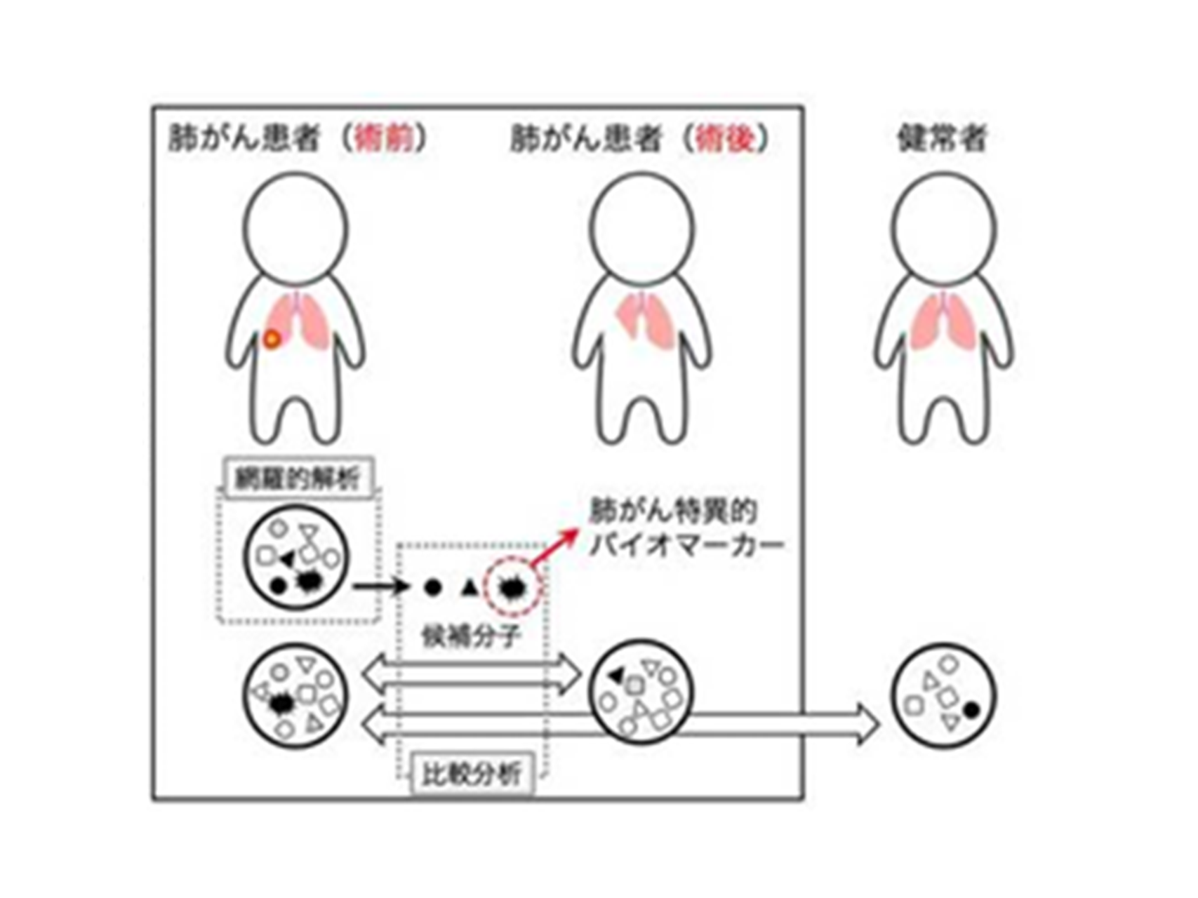 6.①脂質膜小胞による血管再生療法&emsp;&emsp;②肺がん組織から分泌される細胞外小胞の解析による新規バイオマーカー探索 (器官病態外科学講座)
