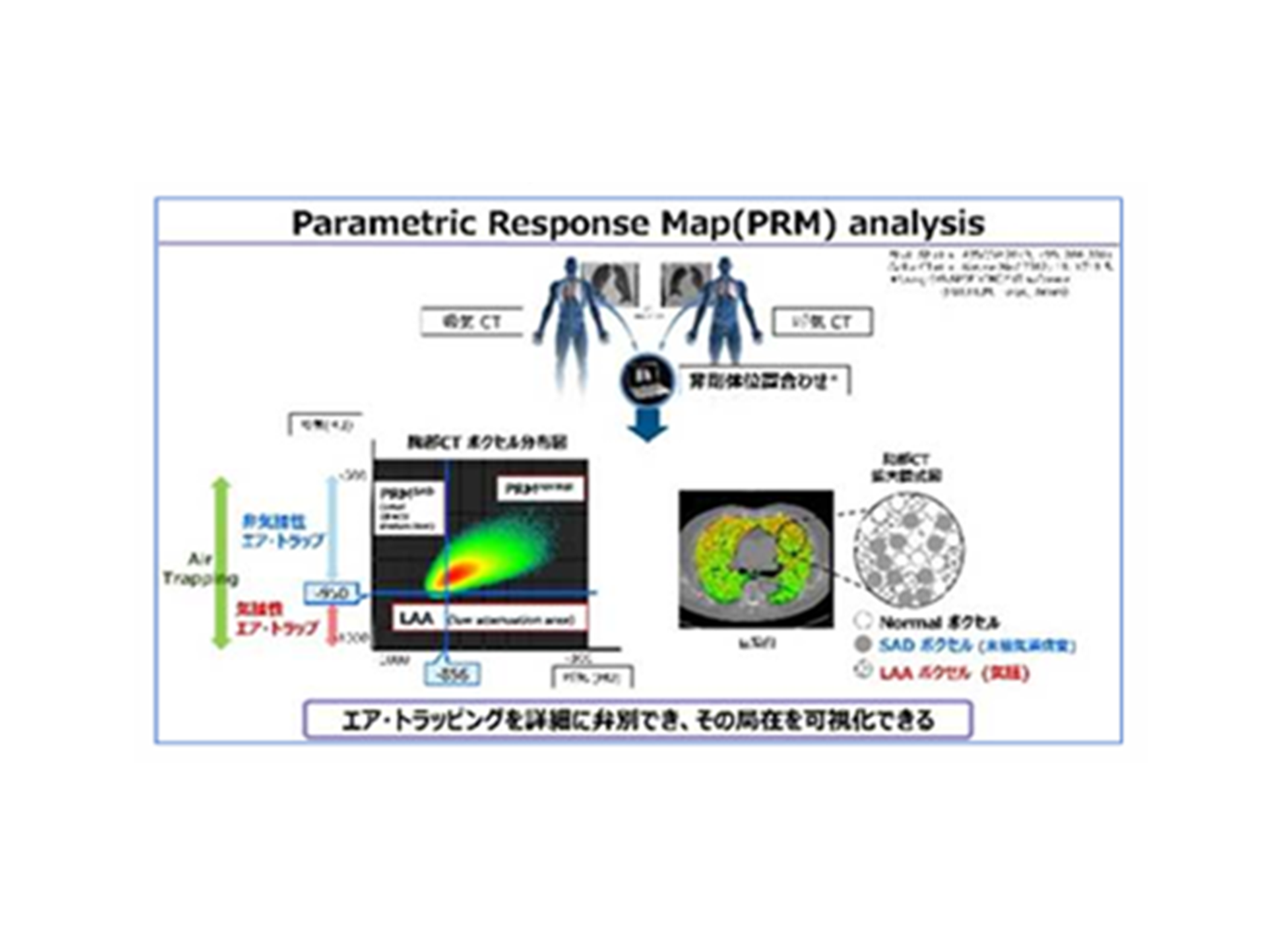 16.呼吸器疾患の健康長寿達成に向けた病態解明と創薬研究の推進&emsp;（呼吸器・感染症内科学講座）