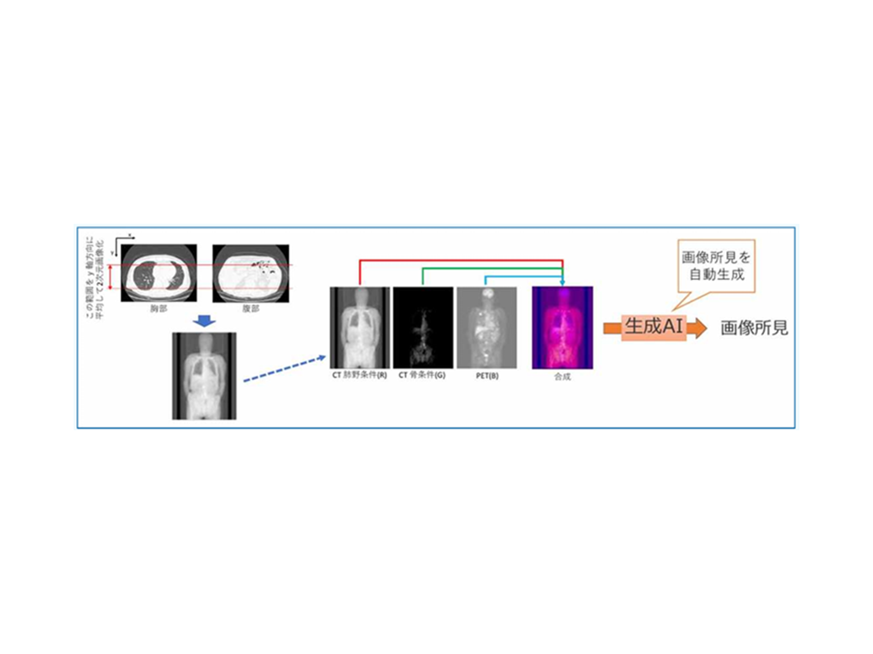 34.AIによる医療情報解析（医療情報判断学講座）