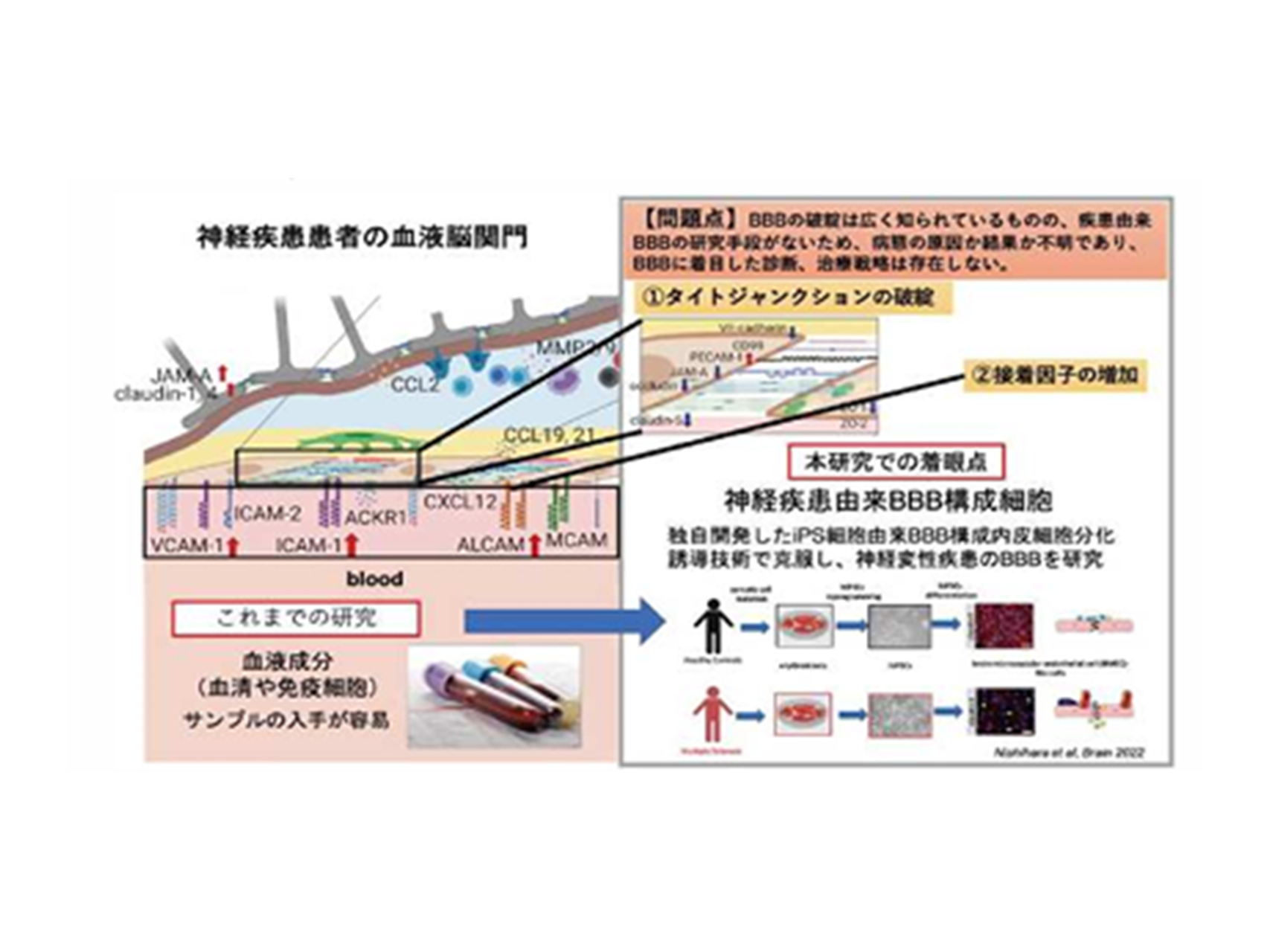 5.血管脳関門という新たな診断、治療ターゲットの確立（臨床神経学講座）