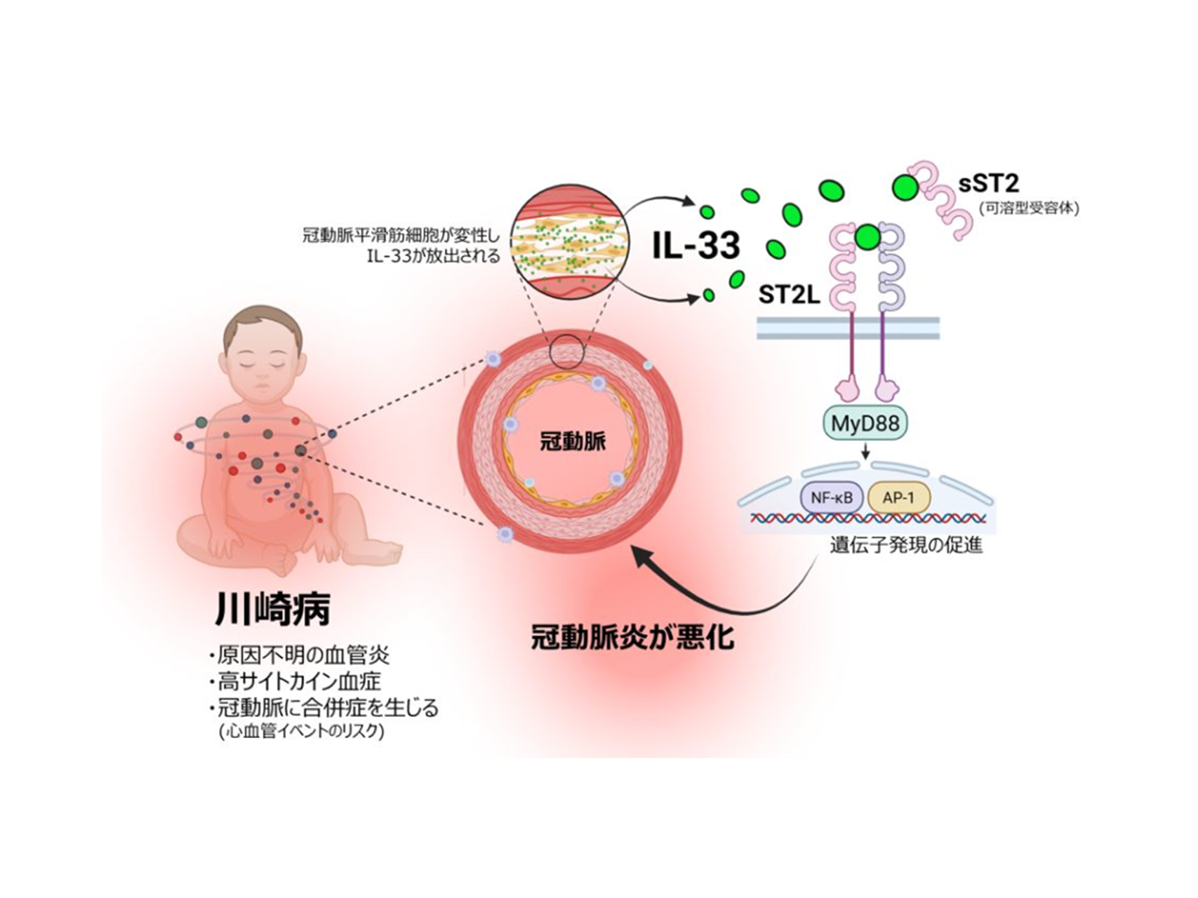 [Review] Elucidating the Mechanism of Inflammatory Amplification in Kawasaki Disease: The Role of the IL-33/ST2 Signaling Pathway